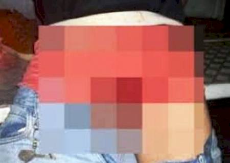 Homem dispara acidentalmente nos testículos ao manusear arma de fogo