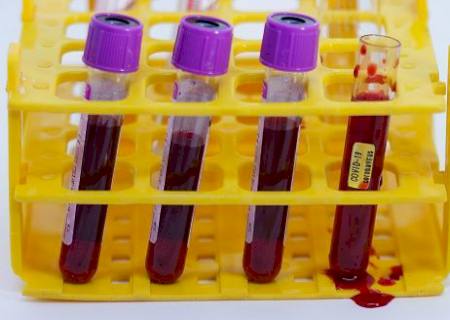 China aprova início de testes de vacinas experimentais contra Covid-19