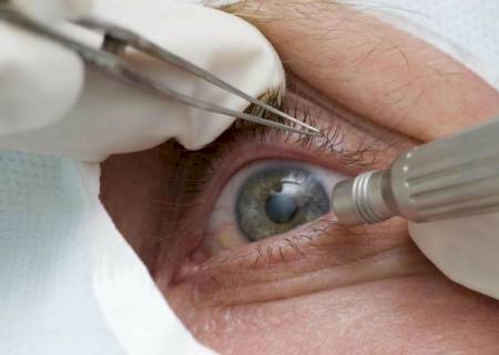 Pandemia faz cair detecção precoce de glaucoma