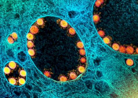 França identifica nova variante do coronavírus com mais de 40 mutações