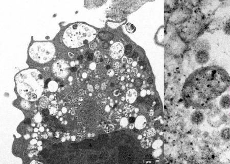 Subvariante da Ômicron é mais infecciosa que ''original'', diz estudo