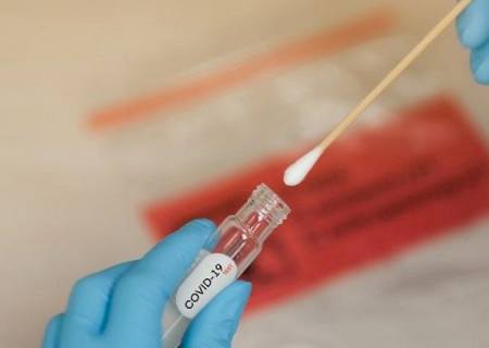 Com redução considerável, MS tem 138 novos casos e 3 mortes por covid na última semana