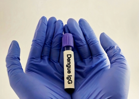 Com registros de dengue e Chikungunya, Nova Andradina realiza força-tarefa para eliminar focos do Aedes aegypti