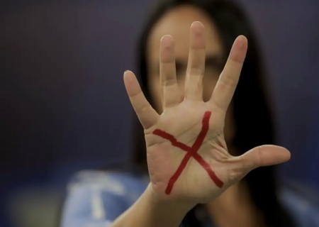 Mulheres vítimas de violência podem ter reconstrução dentária pelo SUS