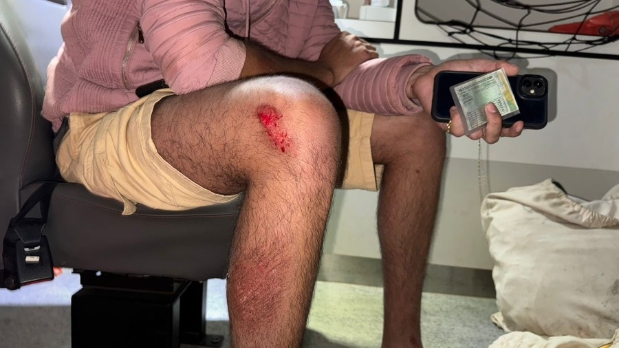 Adolescente entra em via preferencial, colide com moto e dois ficam feridos em Nova Andradina