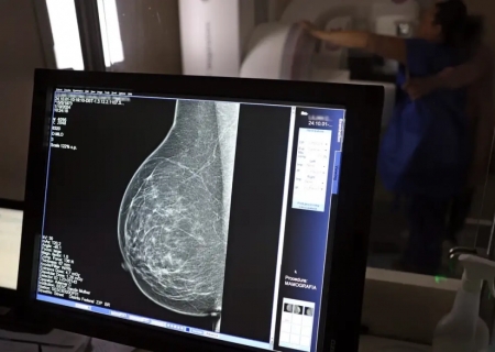 Falta de acesso a mamógrafos limita prevenção do câncer de mama