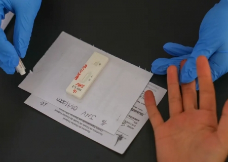 Ministro da Saúde reforça prioridade em novas tecnologias de prevenção ao HIV