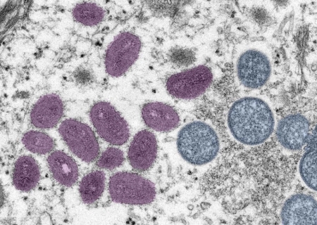 Brasil registra 88 casos de Mpox em 2026; saiba como evitar a doença