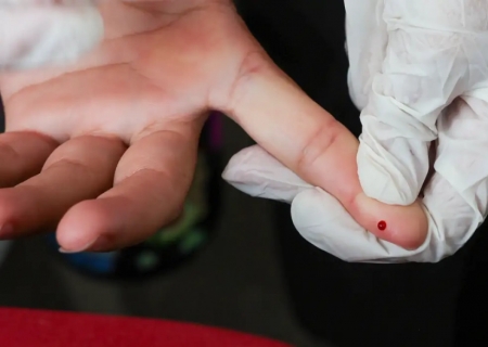 SUS passa a oferecer teste rápido de dengue