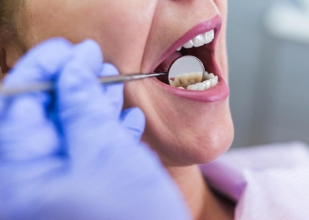 Saúde bucal além da estética: por que ela impacta o bem-estar geral