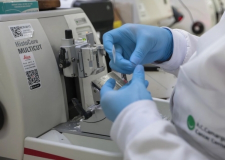 SUS inclui nova terapia para pacientes adultos com leucemia mieloide